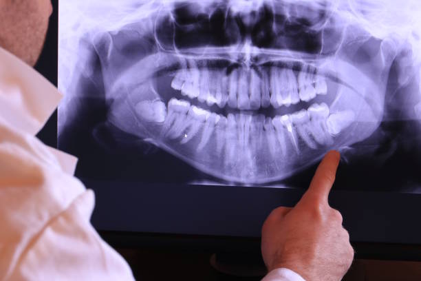 Best Emergency Dental Extractions in Cooperstown, NY